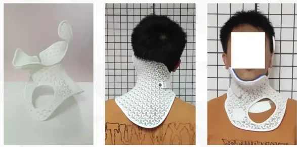 수술 후 목 지지대
