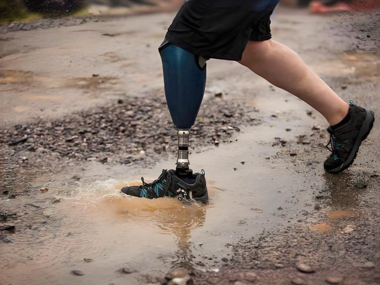 3D Printed Prosthetics Deliver Faster, Smarter, Personalized Care