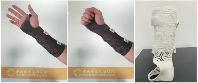 3D printed wrist orthosis