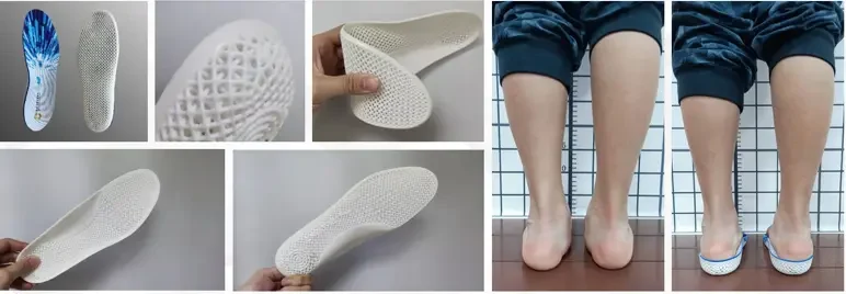 Orthopedic Insoles