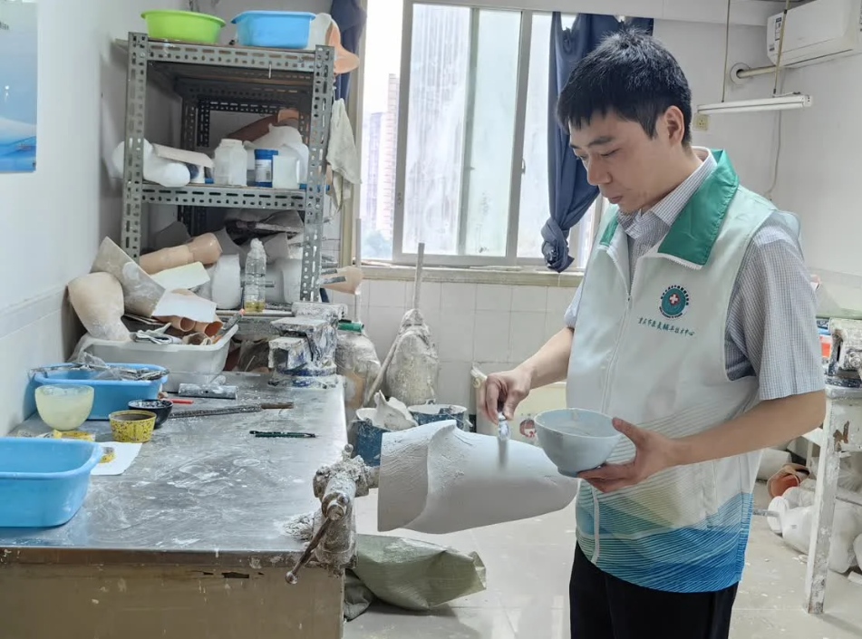 Zhang Wei, Head of the Rehabilitation and Assistive Devices Department at Chongqing Municipal Hospital of Integrated Traditional Chinese and Western Medicine, is creating a plaster model for a prosthetic limb. Image: Xinhua