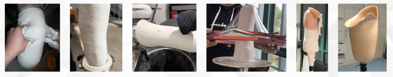 Traditional method of prosthetic fabrication