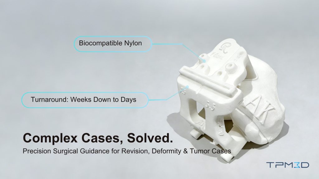 3D-printed surgical guides advancing precision orthopedic care and patient outcomes