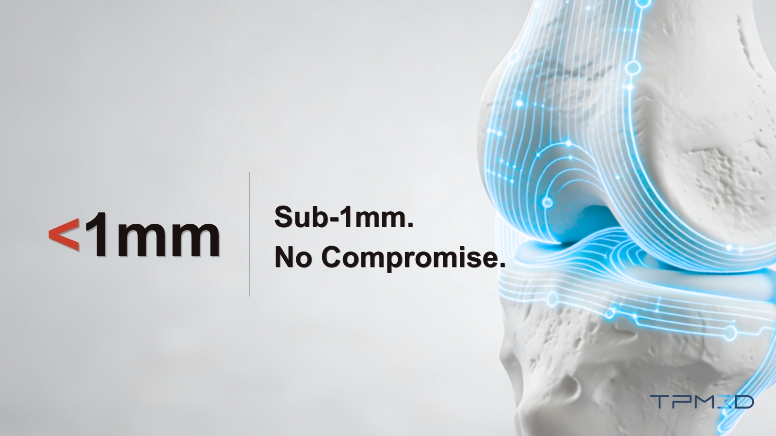 Customized SLS surgical guide based on CT data for accurate bone cutting and drilling